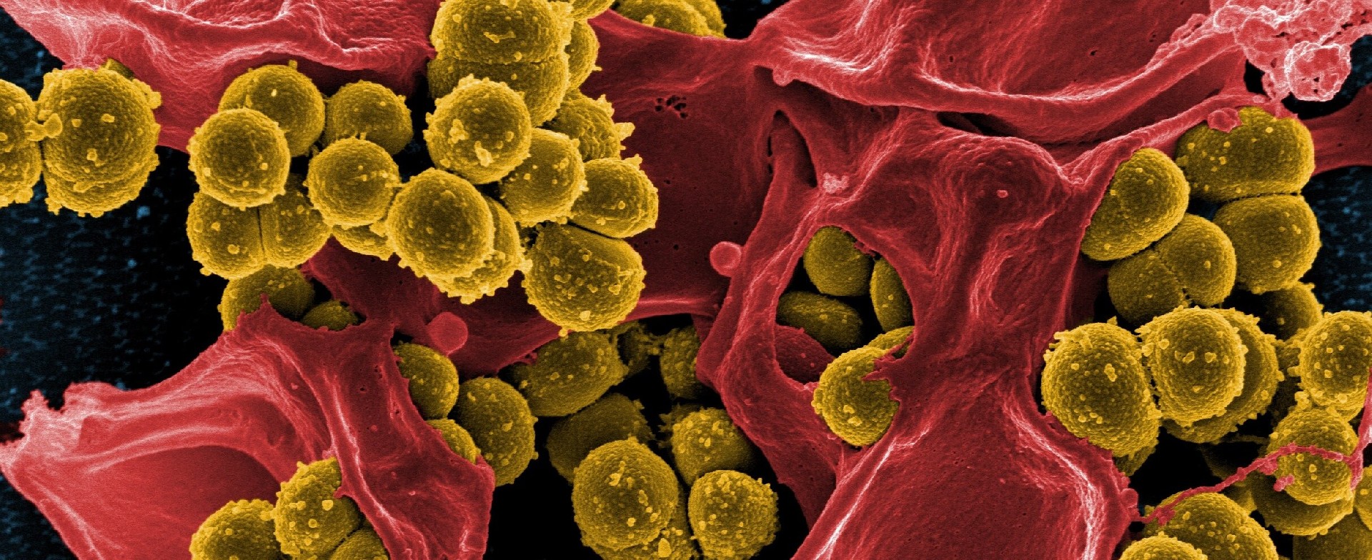 Antimicrobial material